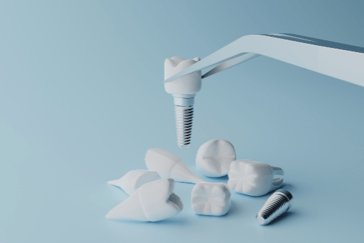 implantes dentales en ribeira